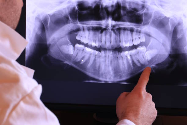 Best Mobile Emergency Dentist in Onsted, MI