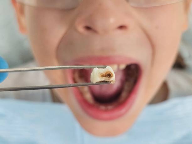 Best Pediatric Emergency Dentist in Onsted, MI