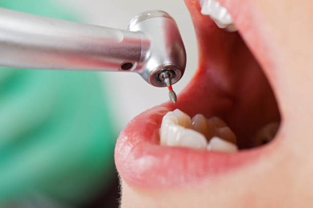 Best Emergency Dentist for Special Needs Patients in Onsted, MI